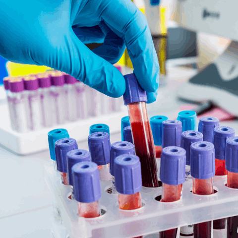Вам назначили биохимический анализ крови. Что это такое и для чего он нужен?